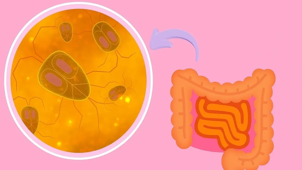 Geçirgen bağırsak sendromu nedir, belirtileri nelerdir, nasıl iyileştirilir?