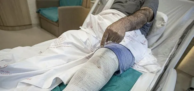 Erzurum’da şoke eden olay! Ağrısını dindirmek için bacaklarına sardığı ısırgan otu hastanelik etti