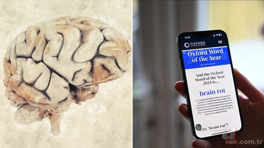 Brain rot nedir, ne demek? Yılın kelimesi seçilen Brain rot (Beyin Çürümesi) ne anlama geliyor? 1