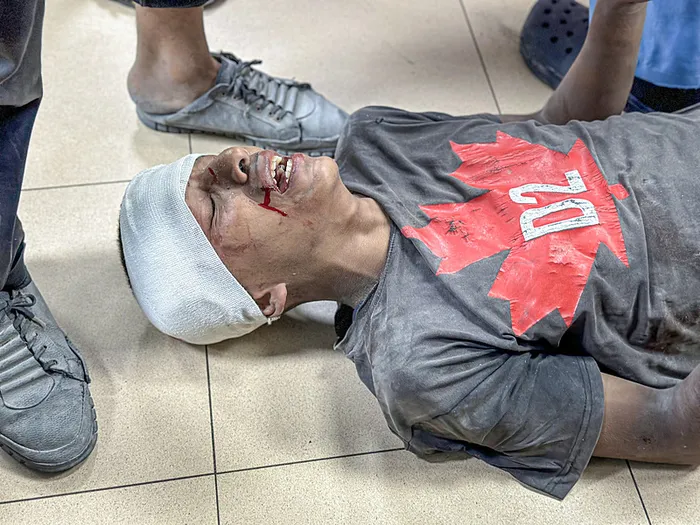 1723117081038.jpg Türkiye'nin İsrail'e karşı hamlesi dünya basınında: Türklerin hamlesi davayı daha da güçlendirdi... - 3