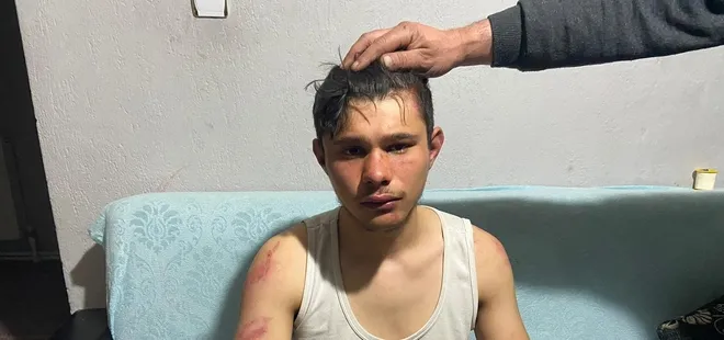 İki yüz lira alacağı olan 16 yaşındaki gence 5 saat işkence