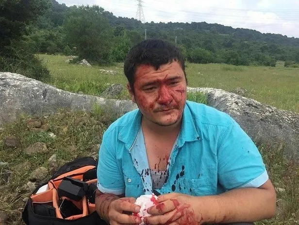Muhabiri öldüresiye döven İYİ Partili Lütfü Türkkan'ın korumalarından skandal ifadeler: Hiç görmedik - 1