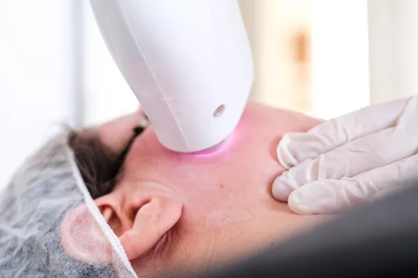lazer-epilasyon-yasaklandi-mi-guzellik-salonlarinda-lazer-epilasyon-yasak-mi-1633438612678.jpg Güzellik salonları lazer epilasyon yasak mı? Lazer epilasyon yasaklandı mı, serbest mi? - 3