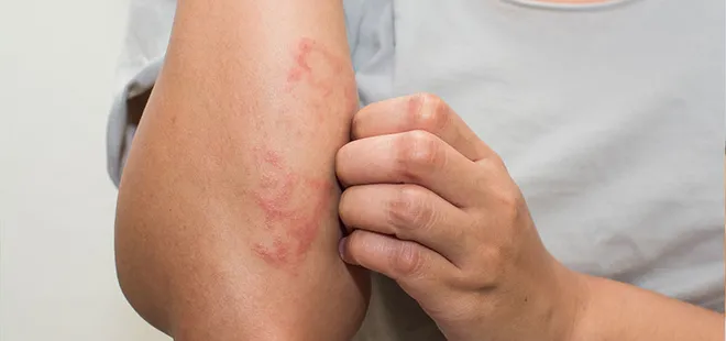 Aman dikkat! Egzamaya davetiye çıkarıyor