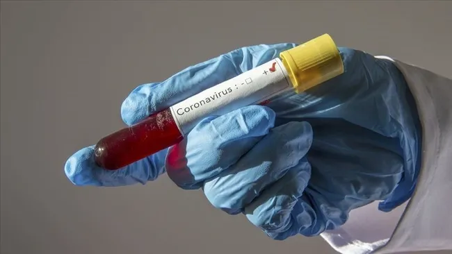 Kovid-19’un genetik şifresini çözen araştırma '2020'nin immünoloji gelişmesi' seçildi - 1