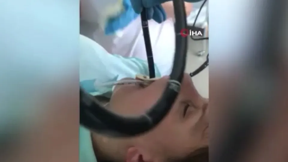 Uyurken ağzından giren yılan ameliyatla çıkarıldı