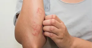 Aman dikkat! Egzamaya davetiye çıkarıyor