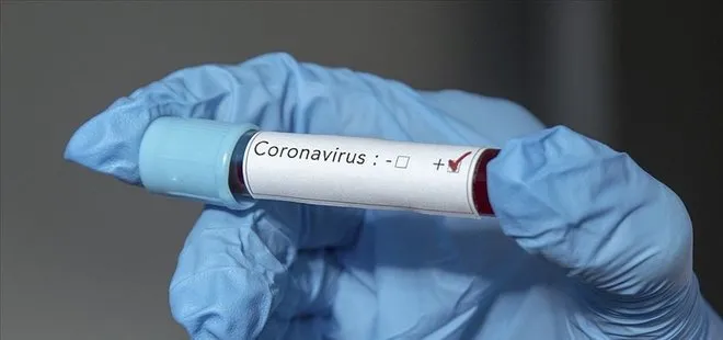 Koronavirüs Ürdün’e de sıçradı!