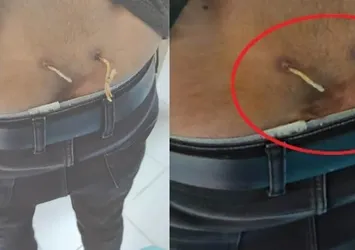 Beline delik açıp çamaşır ipi geçirdiler! Akılalmaz yöntem