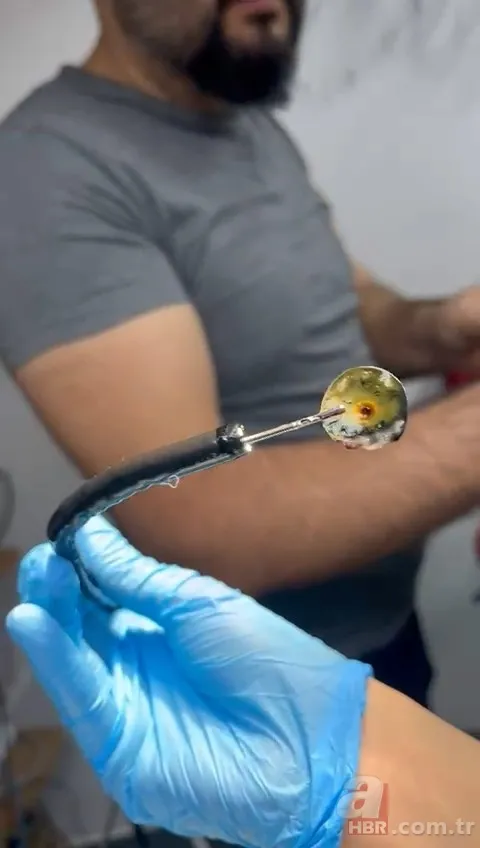 Kedinin midesindeki vantuz 4 yıl sonra fark edildi 7