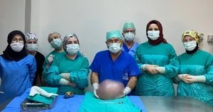 Karnından çıktı! Herkes hamile sanıyordu