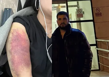 Esenyurt'ta sevgili dehşet saçtı! Genç kadını dakikalarca darp etti: Kedini de öldürürüm