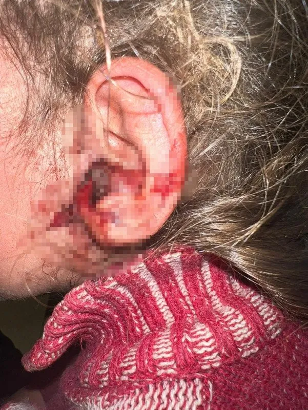 3 yaşındaki kızın kulağından bakın ne çıktı! Doktor mikroskopla kontrol edip hemen operasyona başladı