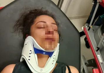 Adana'da pitbull kavgası: Kadının burnunu kırdı