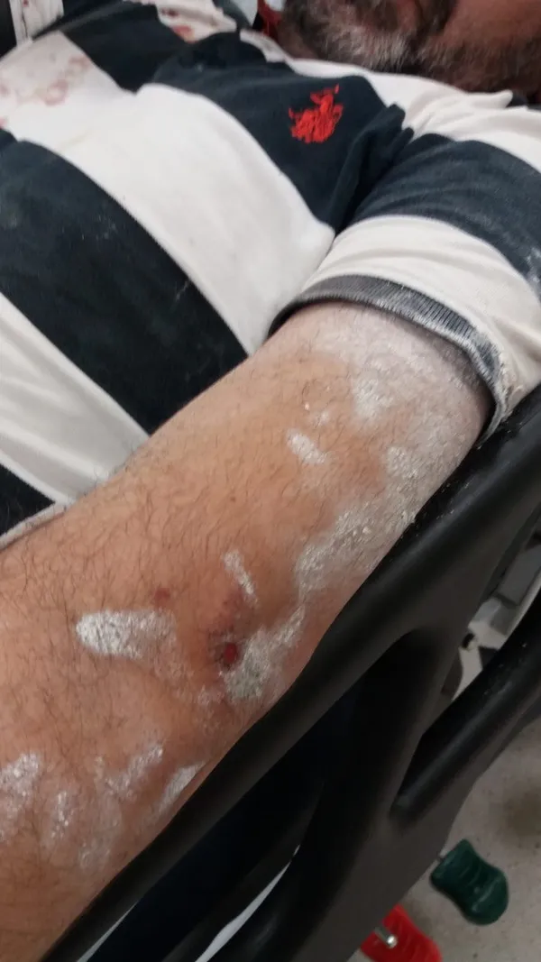 CHP’li Adalar Belediyesi’nin usulsüzlüklerini ifşa etti! Yaşam savaşı veriyor