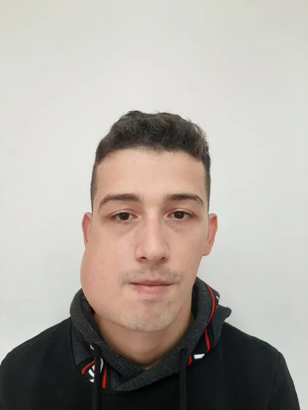 1614758925381.jpg Türkiye'de ilk kez yapıldı! Ameliyat süresi yarı yarıya azaldı - 3