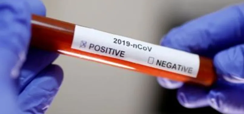 Alavesli 3 futbolcuda koronavirüs tespit edildi