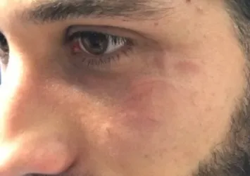 Burak Yılmaz'dan maç sonu Olcay paylaşımı!