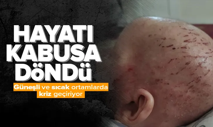 Küçük Tahanın hayatı kabusa döndü