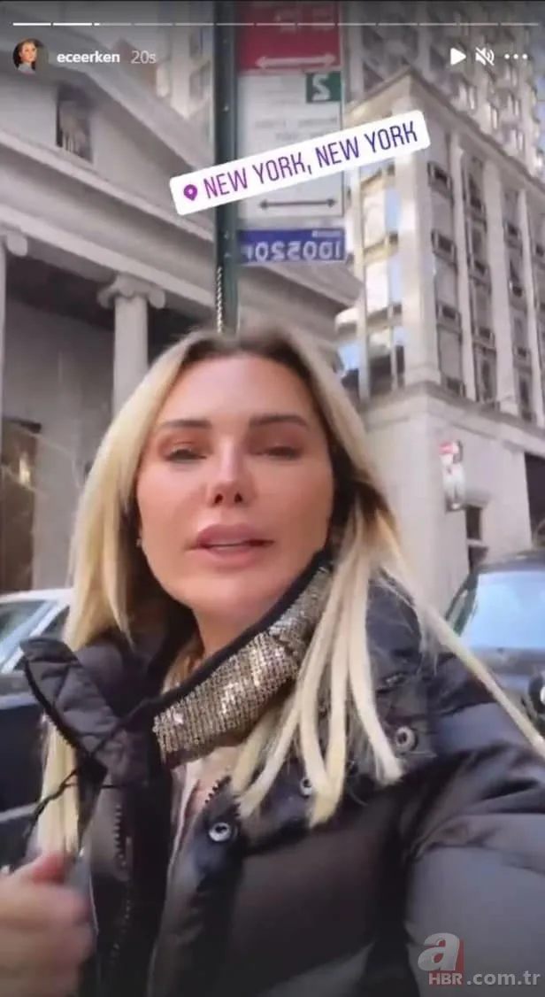 Ece Erken'in yüzüne ne oldu? Erken’in son hali şoke etti! 4