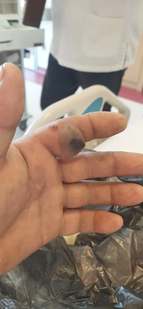 bursada-kendisini-isiran-yilanla-birlikte-hastaneye-kostu-olumle-yasam-arasinda-mucadele-1653561998459.jpg Bursa'da kendisini ısıran yılanla birlikte hastaneye koştu🐍 Ölümle yaşam arasında mücadele - 2