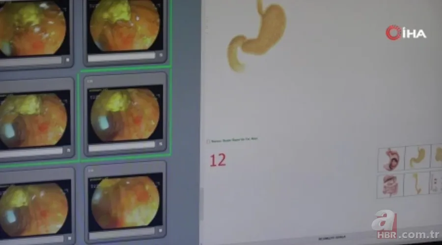 İnanılmaz! Doktorları bile hayrete düşürdü: 66 yıldır iç organları tersine çalışıyor 1