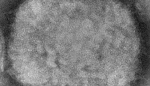 Maymun çiçeği virüsü nedir? Türkiye’de görüldü mü? Maymun çiçeği hastalığı nasıl bulaşır, belirtileri neler?