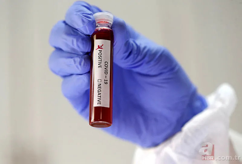 Coronavirüse karşı en önemli silah olan çinko hangi yiyeceklerde var? Çinko açısından zengin besinler nelerdir? 21