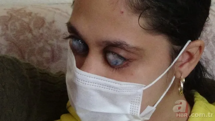 Sosyal medyada fotoğrafını görenler photoshop sanıyor! Genç Ümran’ın gözleri doğuştan…