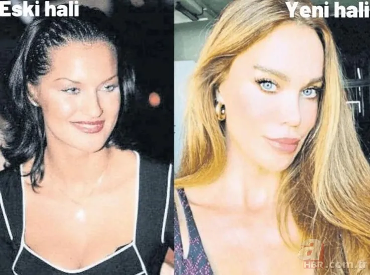 Ebru Şallı 'estetiksizim' dedi! O fotoğraflar ortaya çıkınca alay konusu oldu! Farkı görmemek mümkün değil 8