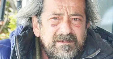 Feridun Düzağaç’ın son hali korkuttu