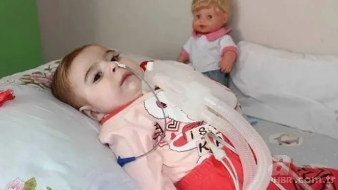 SMA hastalığı nedir, ne zaman ortaya çıkar? SMA teşhisi nasıl konur? Tedavisi, belirtileri, SMA testi... 9