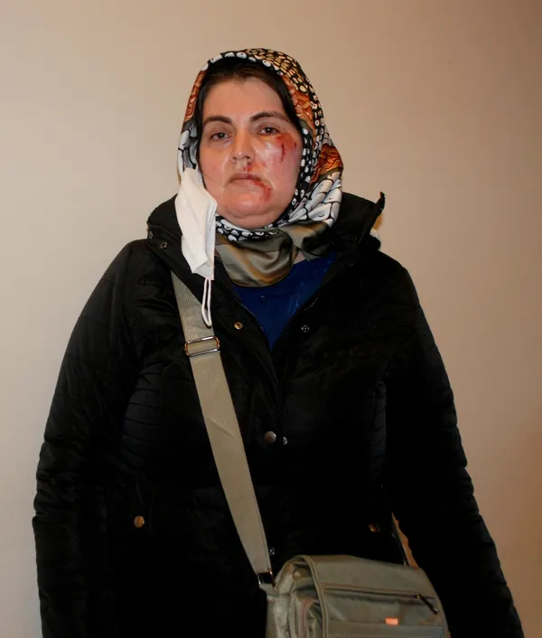 Yolda yürürken tanımadığı kişi tarafından darp edildi: İnsanlar tutmasa beni öldürebilirdi - 1