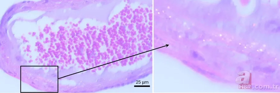 İnsan beynini bekleyen büyük tehlike! Plastikle doluyor... 6