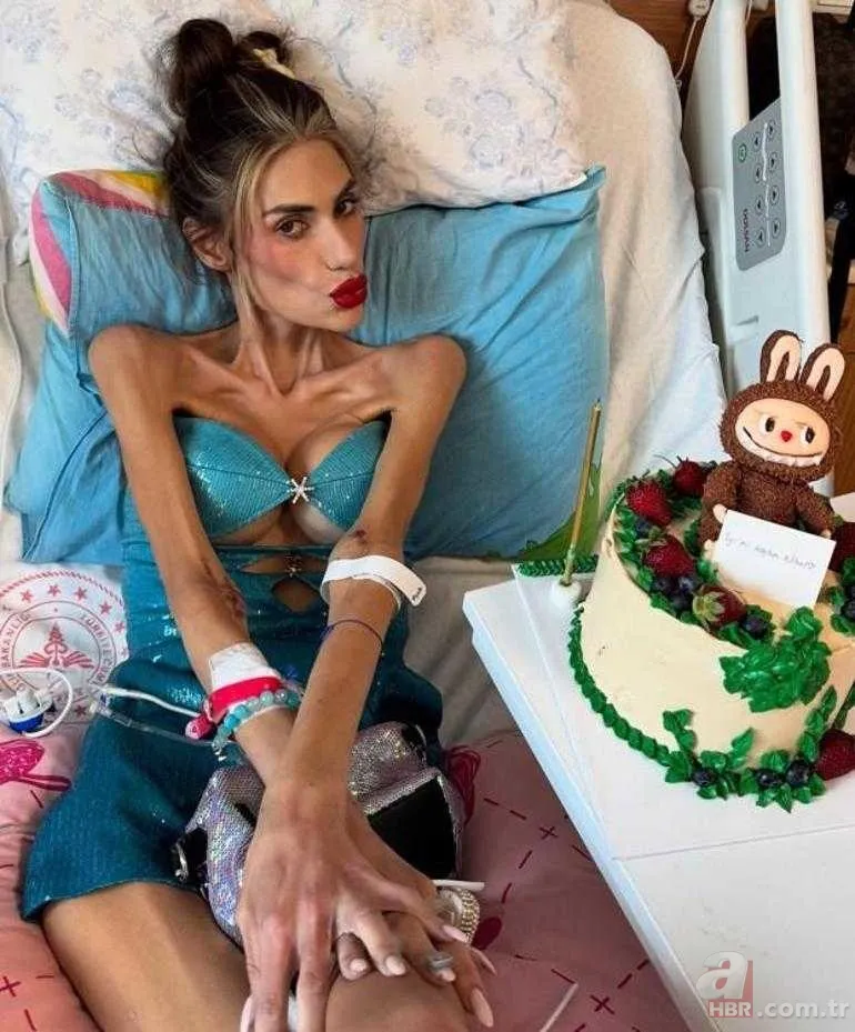 Anoreksiyadan hayatını kaybeden Nihal Candan'ın acılı babası konuştu: Şöhret dünyasına girince sapıttı 6