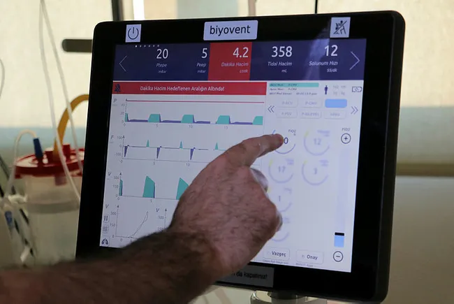 Yerli solunum cihazı ülkeye 90 milyon dolar katkı sağladı - 1