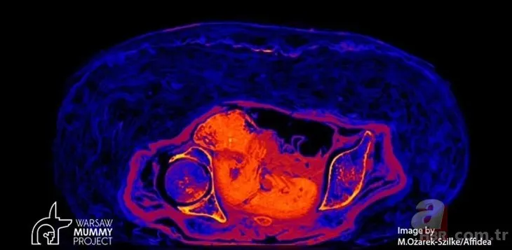 Doğmamış çocuğuyla mumyalandı: 2 bin yıl nasıl bozulmadan kaldı? Gerçek bir insanlık trajedisi