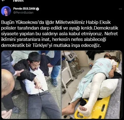 Teröristbaşı Öcalan için yürüyen HDP’lilere polis geçit vermedi: HDP vekili hastaneye kaldırıldı