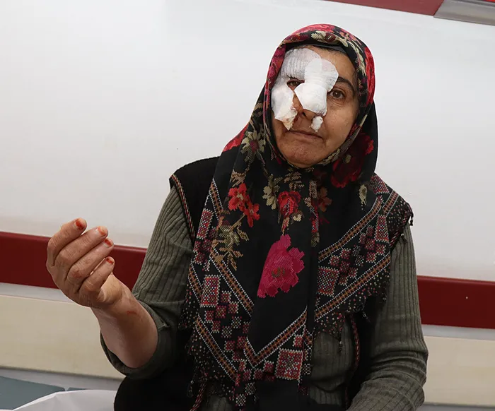 1716896826083.jpg 4 sokak köpeğinden kaçan kadın 12 basamaklı merdivenden yuvarlandı: Beni paramparça edeceklerdi - 1
