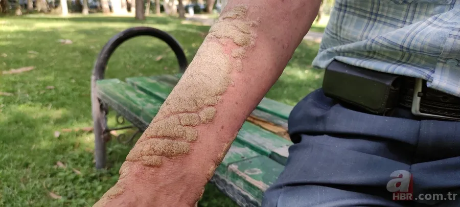 3 senedir gözlerini kapatamıyor! Sağlığına kavuşmak için Türkiye’ye geldi 16