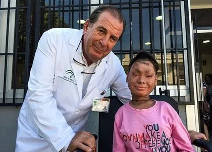 Hastalığı nedeniyle insanların içine çıkamıyor! Yılan kız son haliyle şaşırttı