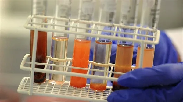 Beyin kanserine karşı dev keşif! Türk bilim insanı Prof.Dr. Aziz Sancar tarih vererek duyurdu