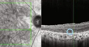 Doktorlardan mucizevi tedavi!