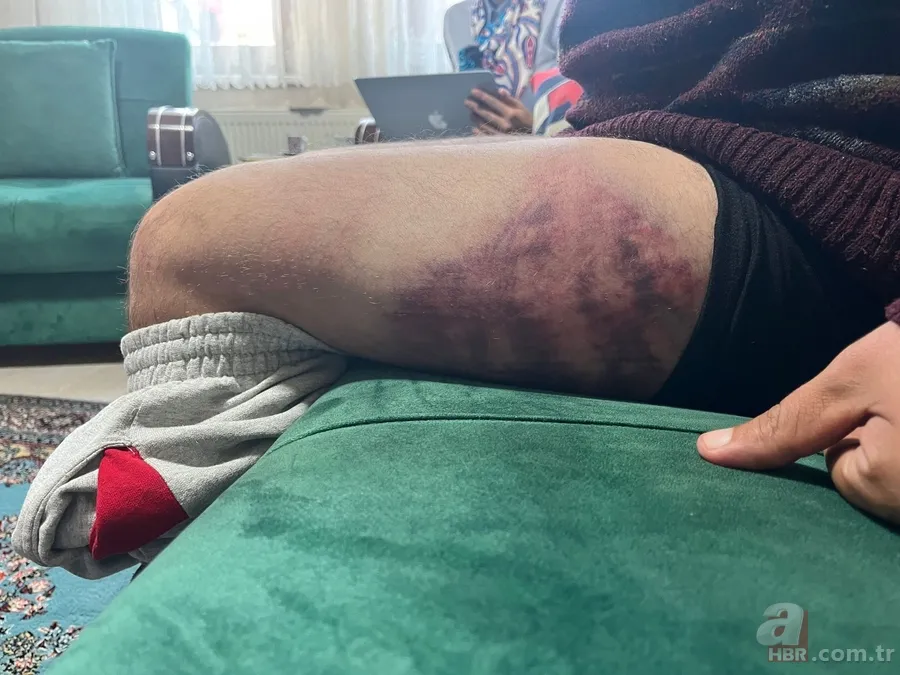 Otizmli vatandaşa “Niye bakıyorsun?” dayağı: Vicdan sahibi insan böyle bir şey yapmaz 6