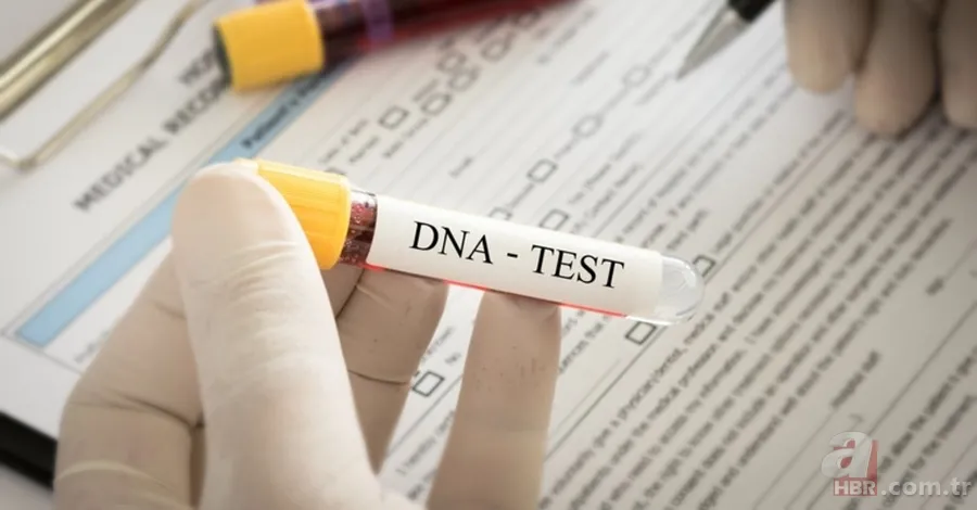 İkizlerin farklı babalardan olması mümkün mü, daha önce yaşandı mı? Heteropaternal süperfekondasyon nedir, ne anlama gelir? 2