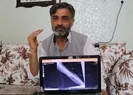Elindeki şişlik için hastaneye gitti hayatının şokunu yaşadı!