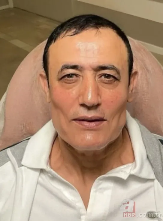 Türkücü Mahmut Tuncer'i bir de estetikli görün! Son hali sosyal medyayı salladı! "Aramıza hoş geldin..." 3