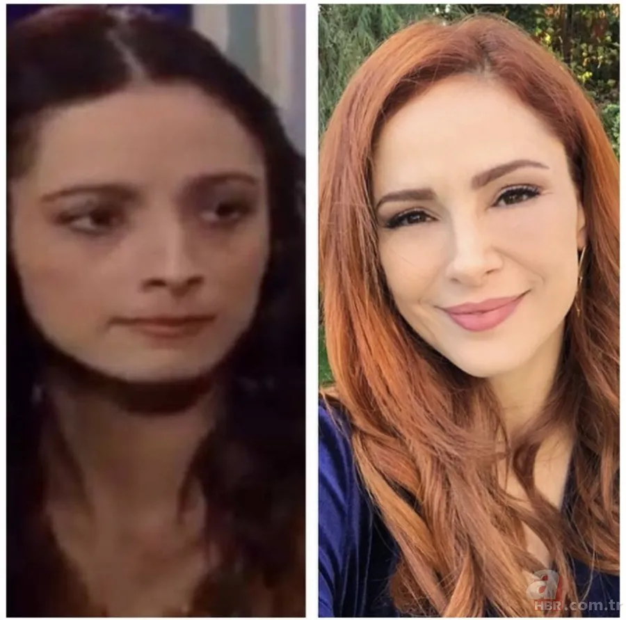 Kuzey Yıldızı İlk Aşk oyuncusu Aslıhan Güner estetik harikası çıktı! Değişimi şoke etti 4