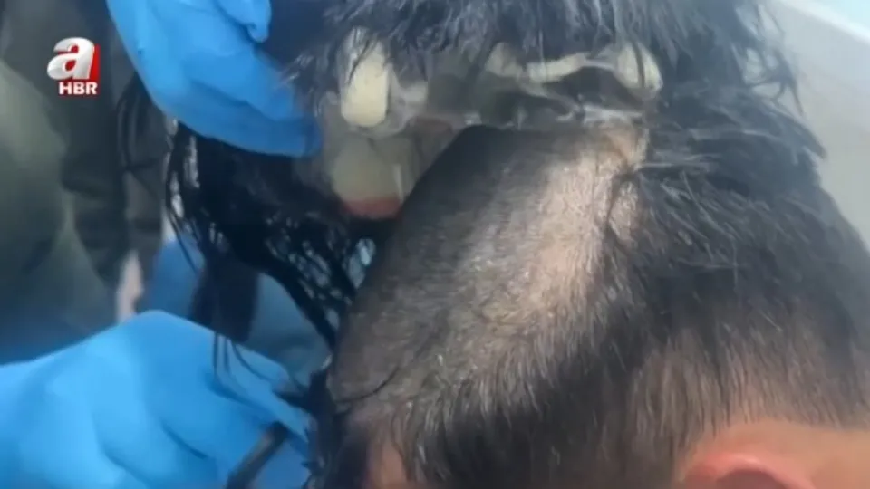 Peruğundan 19 kokain kapsülü çıktı!