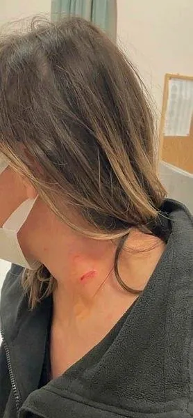 CHP Muğla İl Yönetim Kurulu üyesi Mehmet Engin Yıldızhan’dan trafikte kadına şiddet! Kadının boğazını sıktı